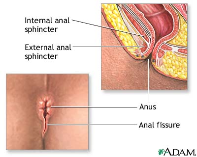 Tightening of anus sphincter